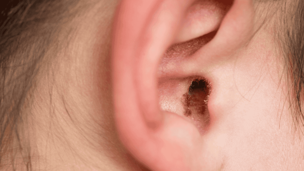 Earwax removal at Hodgson Pharmacy