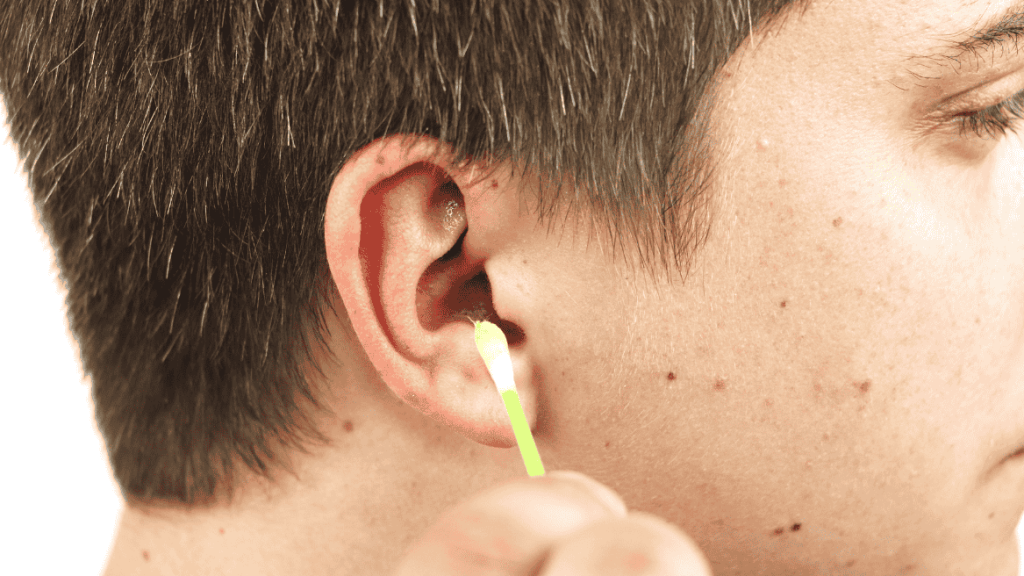 Earwax Removal at Omnicare Pharmacy - What to Expect Before, During & After
